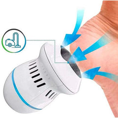 Lixador e Esfoliador Elétrico de Pés